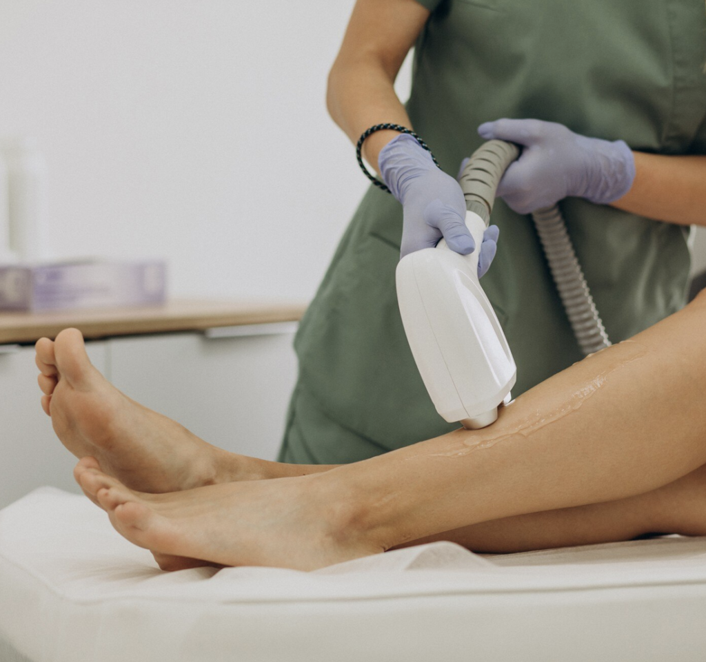 epilation-laser
