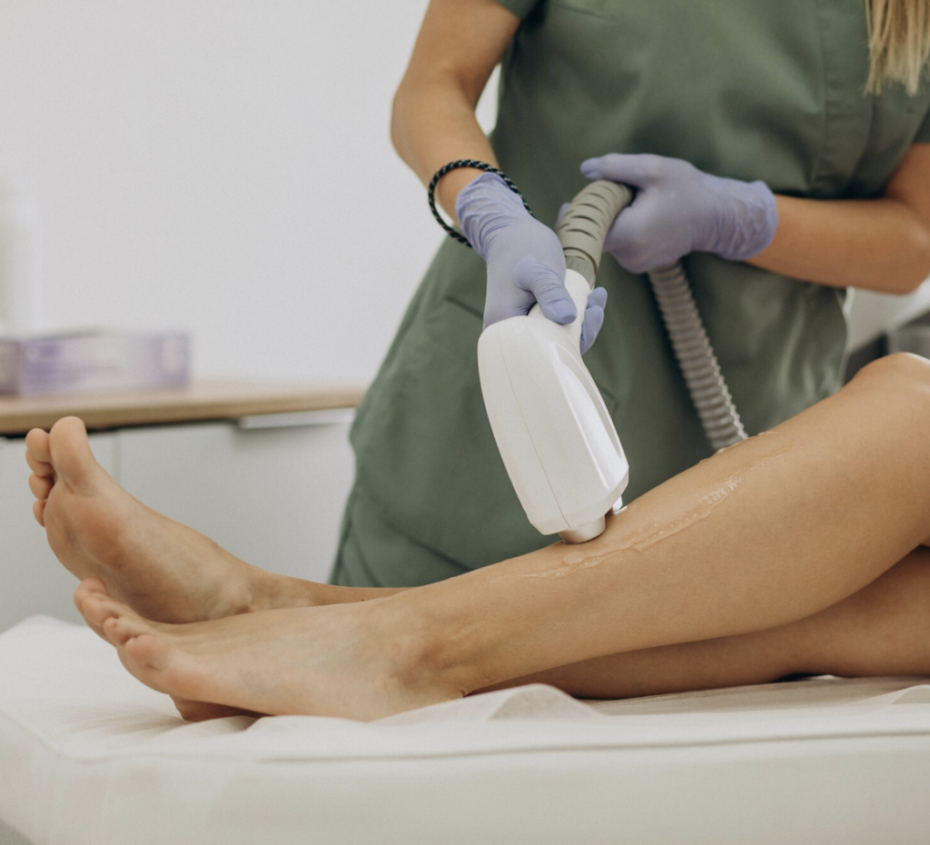 epilation_definitive_au_laser